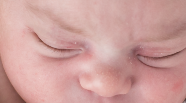 milk bumps and skin flakes newborn photoshop action