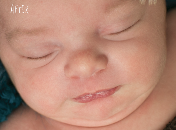 milk bumps and skin flakiness newborn photoshop action